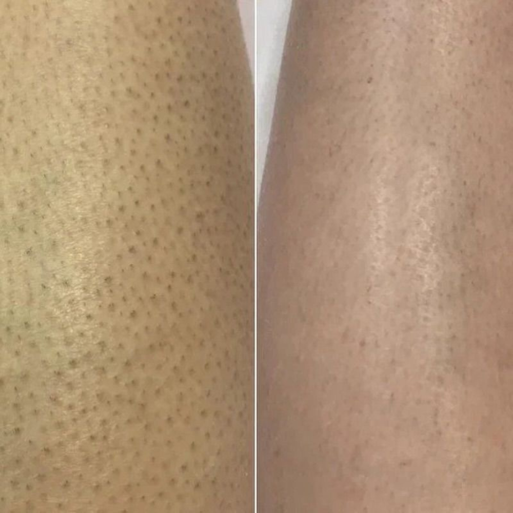 قفاز كيسا الفاخر